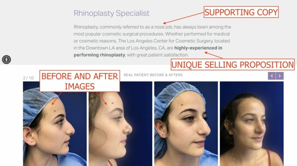 landing page example with before and after photos for face cosmetic procedure