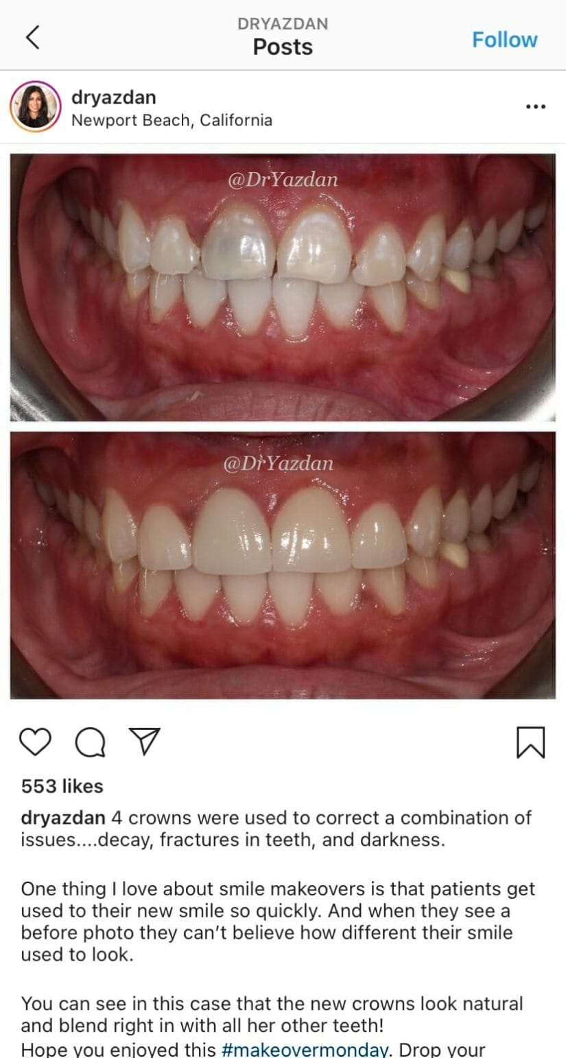 Instagram post from a dental clinic
