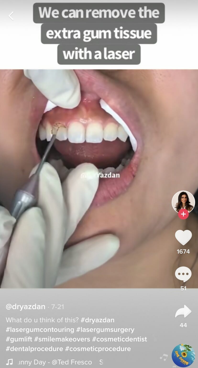 unique procedure video for your video marketing for dentists