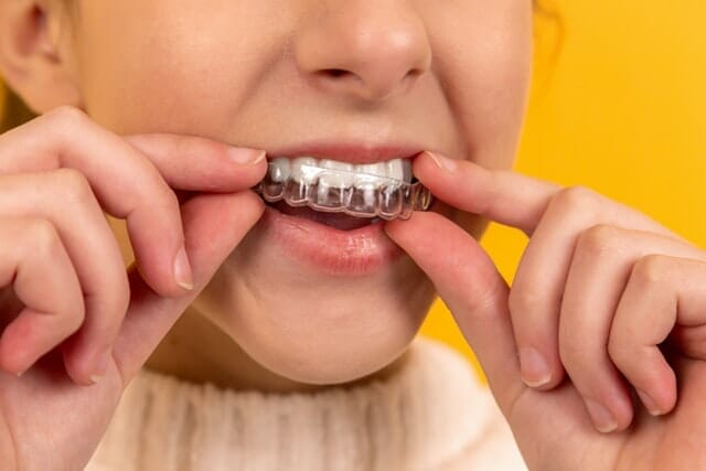 A girl wearing dental retainers