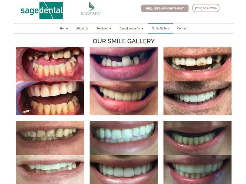 Compilation of before and after a dental treatment