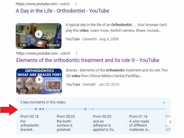 Timestamp of an orthdontic video on Google's SERP