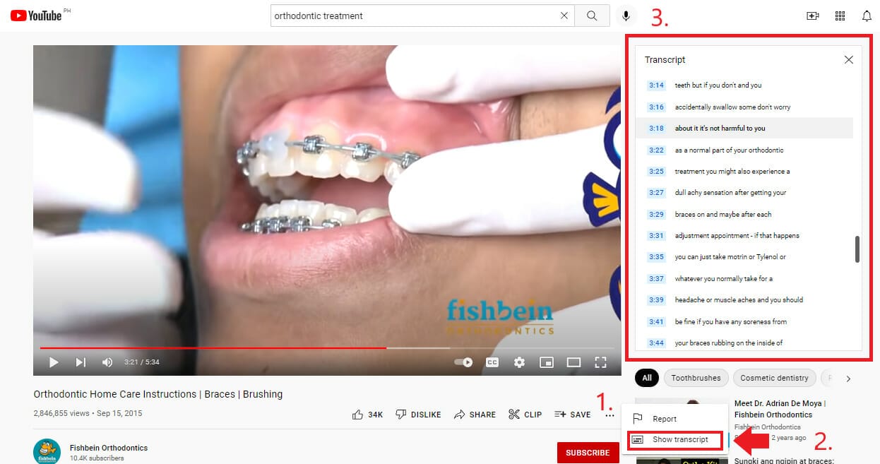 Sample transcript of an orthodontic video on Youtube