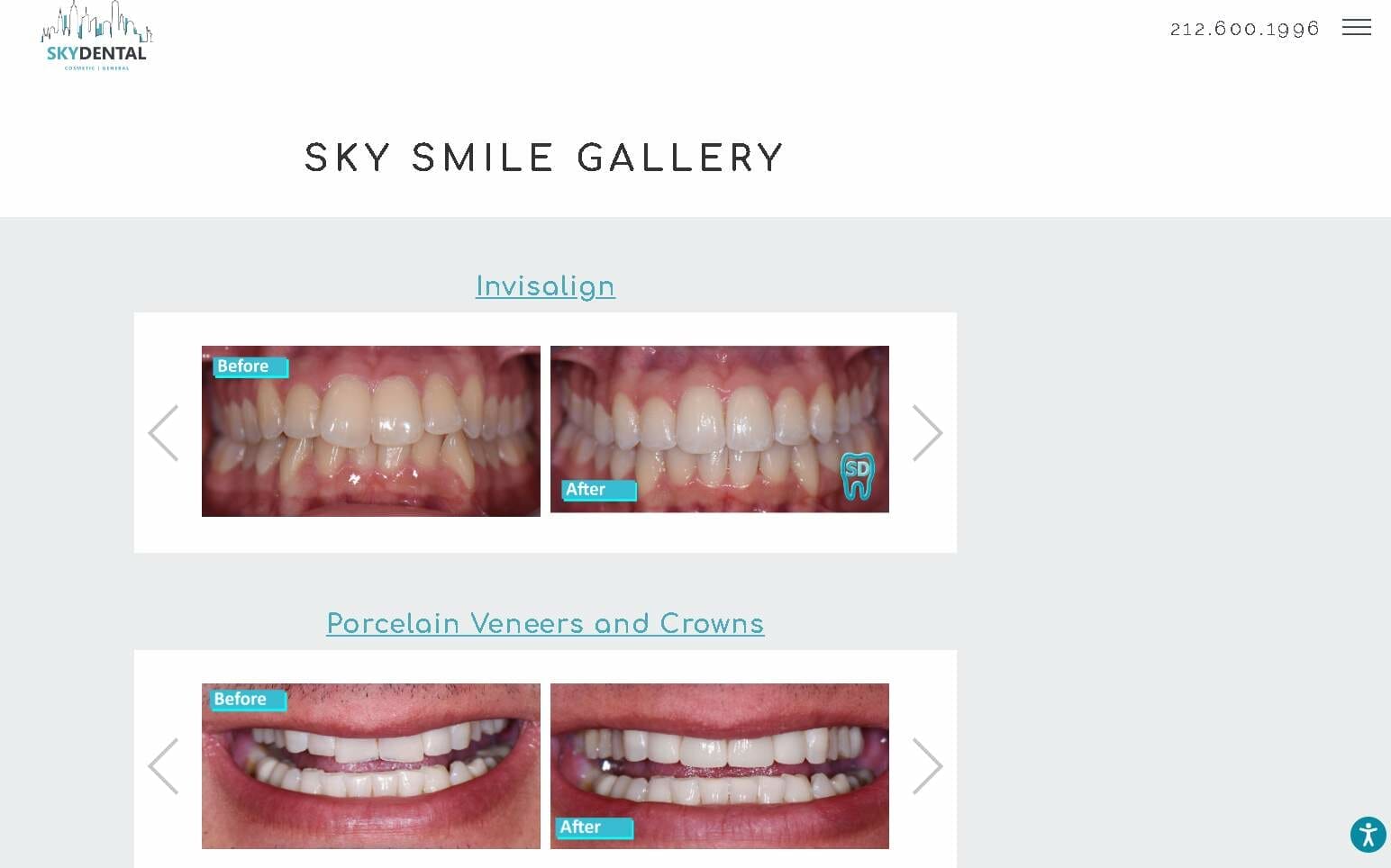 Smile gallery in carousel layout from Sky Dental