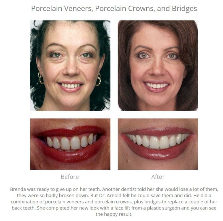 Smile gallery that tells a patient's story behind the transformation