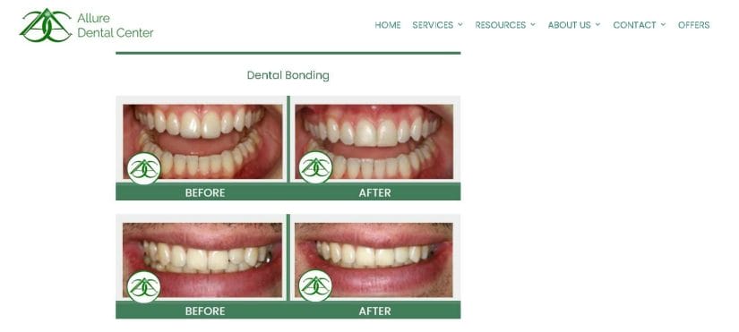 Smile Gallery from Allure Dental Center
