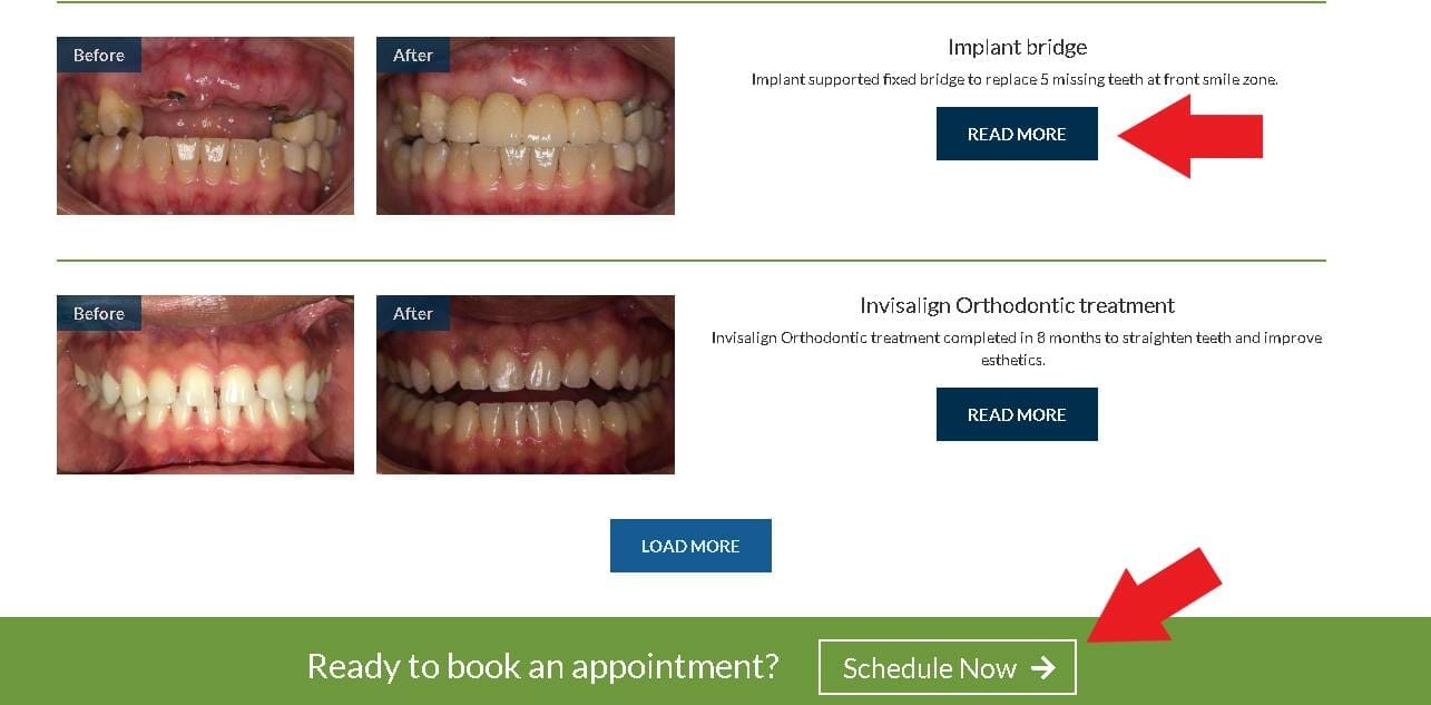 Dental smile galleries with call-to-action buttons
