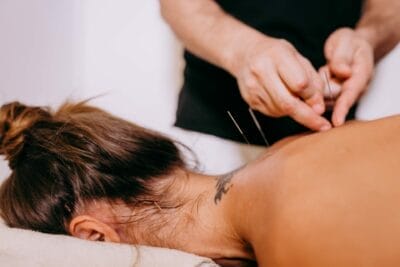 back acupuncture treatment