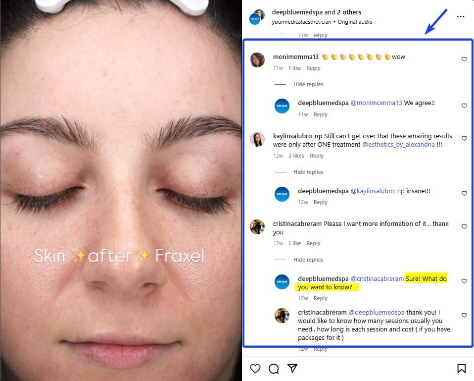 Instagram Comments