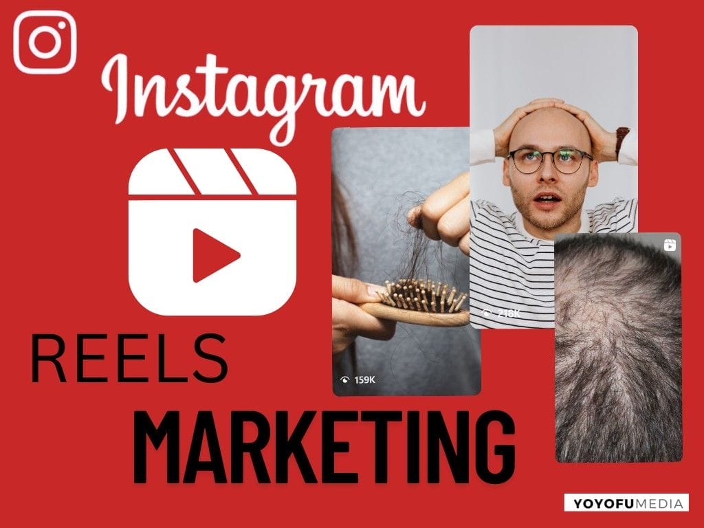 Instagram Reels Marketing for Hair Transplant