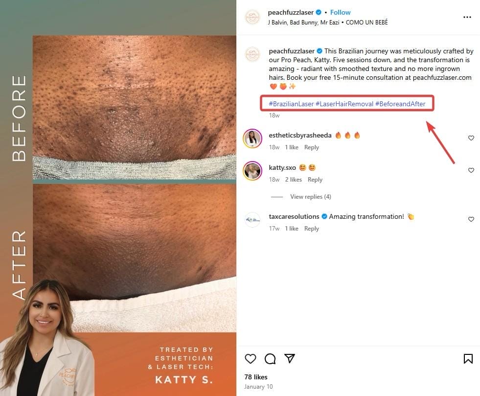 Hashtags for Instagram Hair Removal Reels
