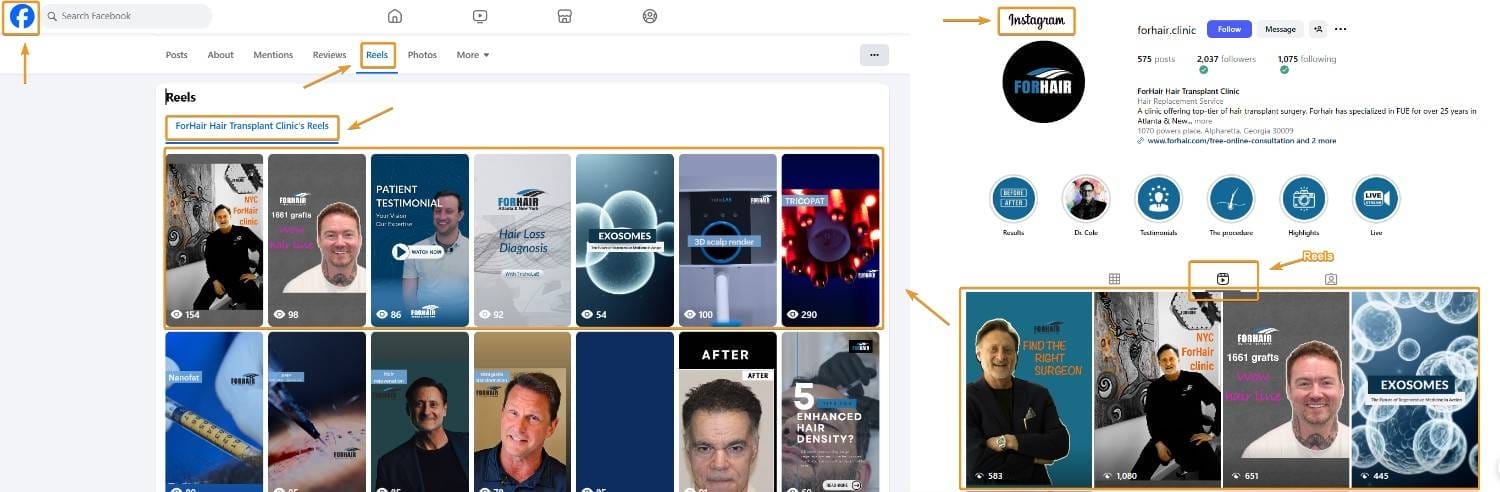 Instagram Reels to Facebook Reels