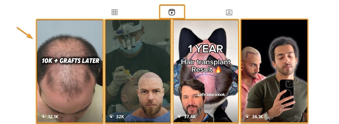 Reel Cover/Thumbnail